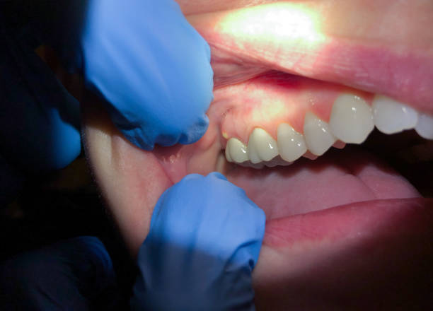 Best Emergency Treatment for Toothache in Genoa, AR
