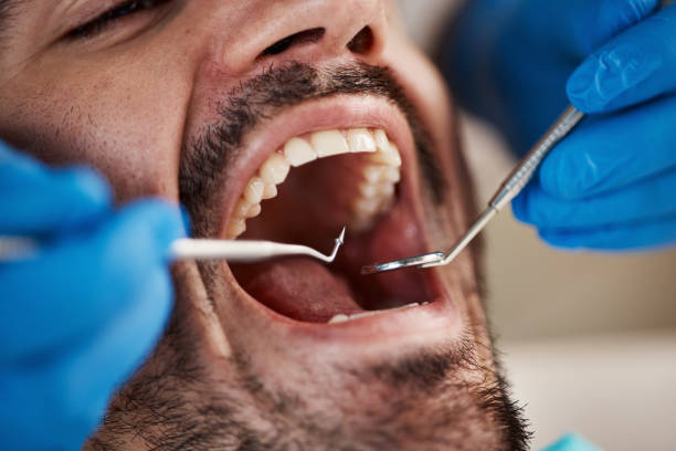 Best Emergency Root Canal Treatment in Genoa, AR