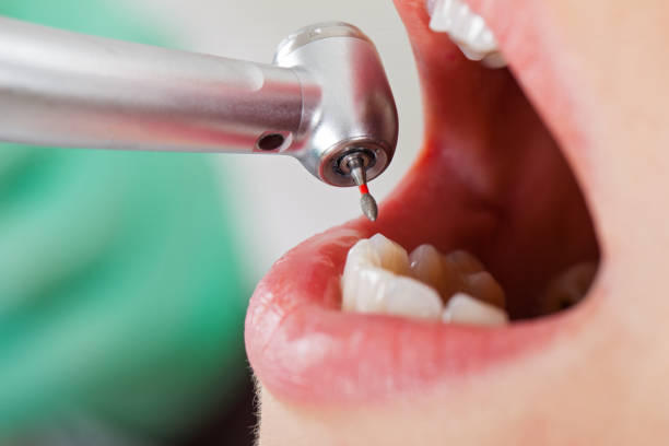 Best Emergency Wisdom Teeth Removal in Genoa, AR
